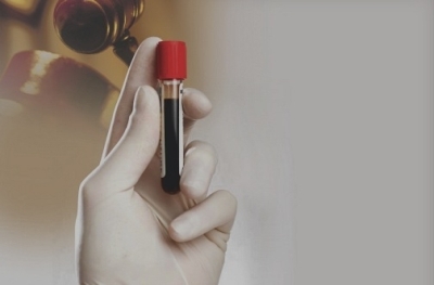 HIV AIDS Anti Retoviral Drug