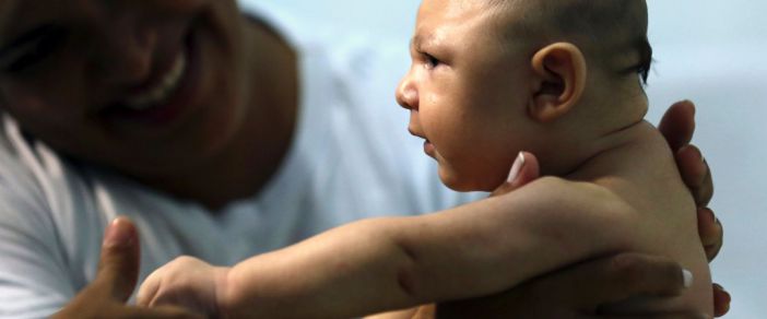 CDC Confirms Zika Virus Causes the Brain Birth Defect Called Microcephaly
